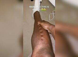 Il est fier de montrer comment sa peau réagit (bizarrement)