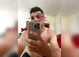 He gets a little hurt falling off a horse