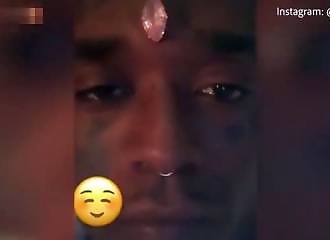 Le rappeur Lil Uzi Vert se fait implanter un diamant sur le front