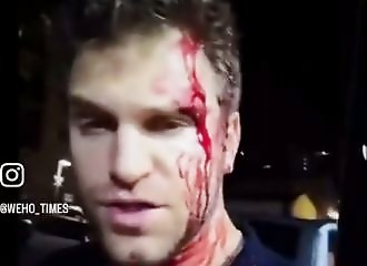Un acteur de Pretty Little Liars pris à partie pour sa montre, frappé à coups de crosse en pleine rue