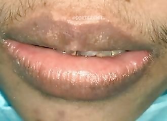  This guy's got tartar all over him 