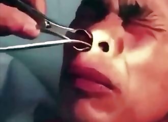 Une horreur est sortie de la narine d’un homme