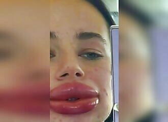 She reacts badly to an injection 